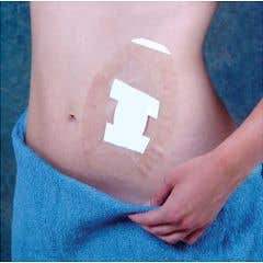 SEAL-TIGHT Shield - Shower Patch - Pack of 5