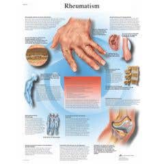Anatomical chart: rheumatic diseases, paper