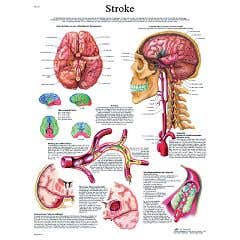 Anatomical chart: stroke chart, paper