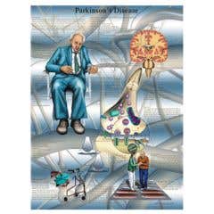Anatomical chart: Parkinson's disease, paper