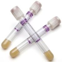 BD Vacutainer PPT Plasma Preparation Tube - 13x100 mm 5.0 mL - Box of 100