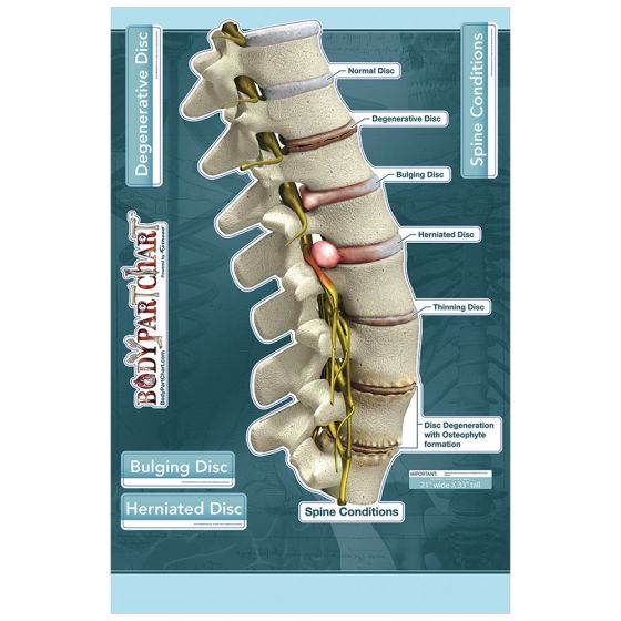BodyPartChart Spine Conditions - Labeled Wall Decal