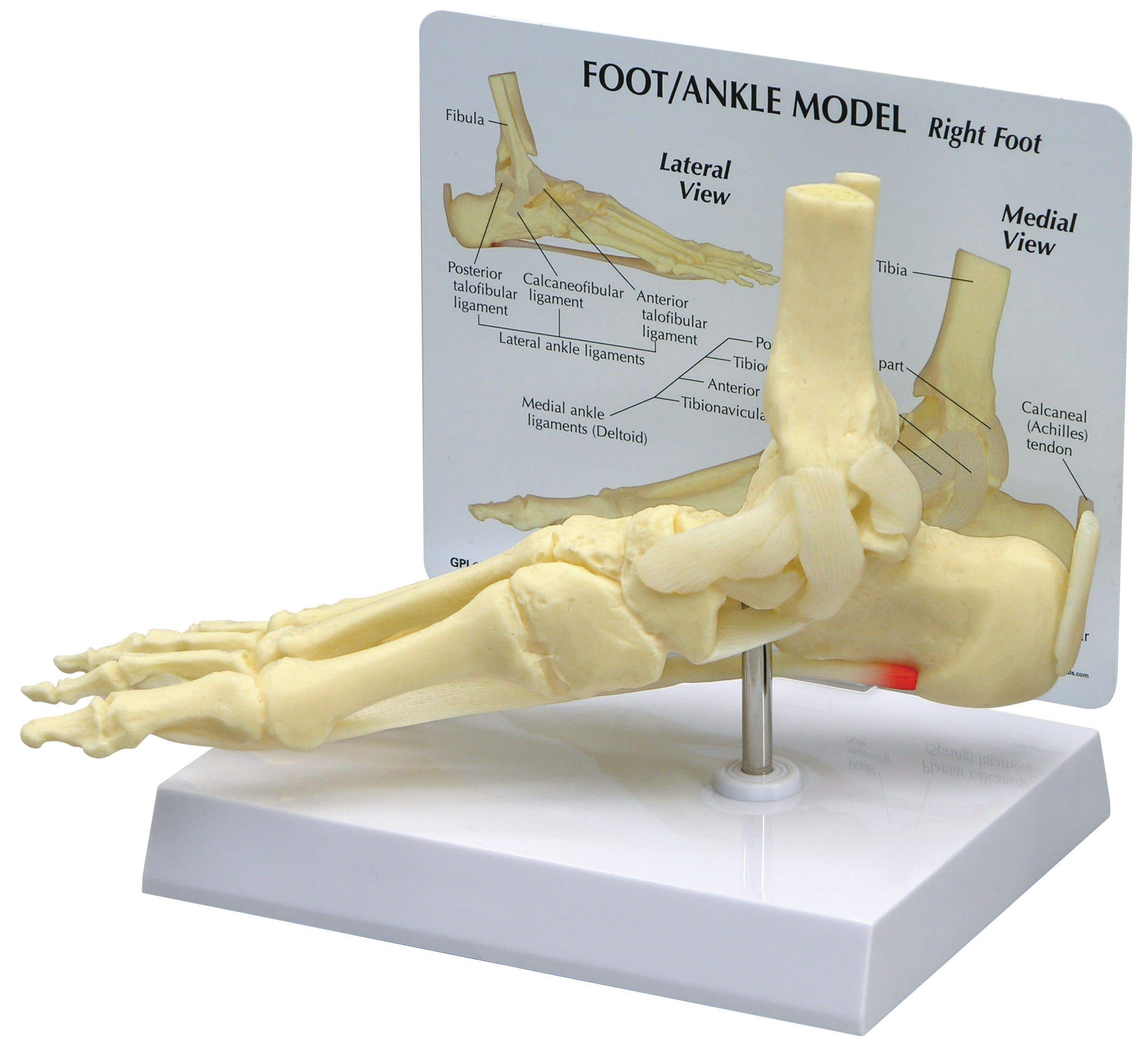 Ankle/Foot Plantar Fasciitis W/ Key Card